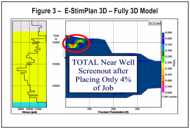 E-StimPlan&trade; 3D Fully 3D Model